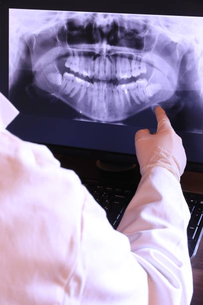 Best Emergency Dentist for Lost Fillings or Crowns in Bacliff, TX
