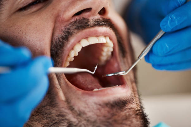 Best Orthodontic Emergency Dentist in Bacliff, TX